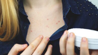 sensitive skin3